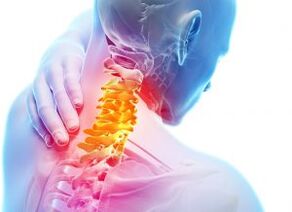 Pain and shelter in the cervical area with the third degree of osteochondrosis